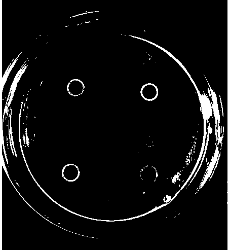 Application of Lactobacillus paracasei combined with car-t cell therapy