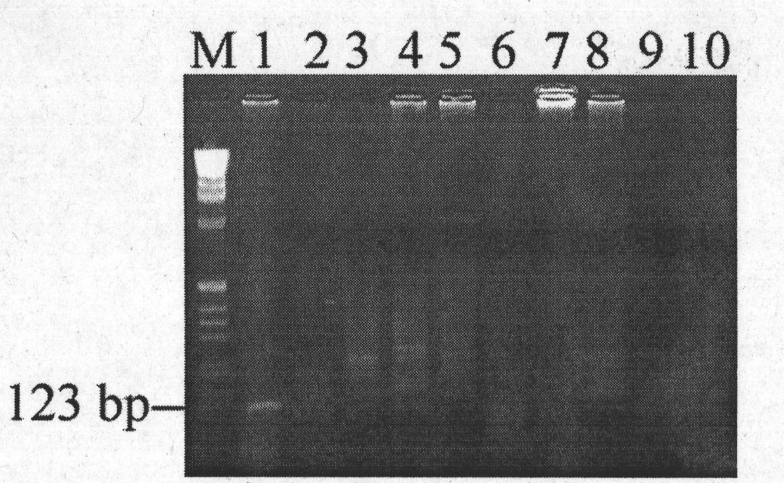 RT-PCR (Reverse Transcription-Polymerase Chain Reaction) detection kit and method for prawn infective muscle necrosis virus by one-step process