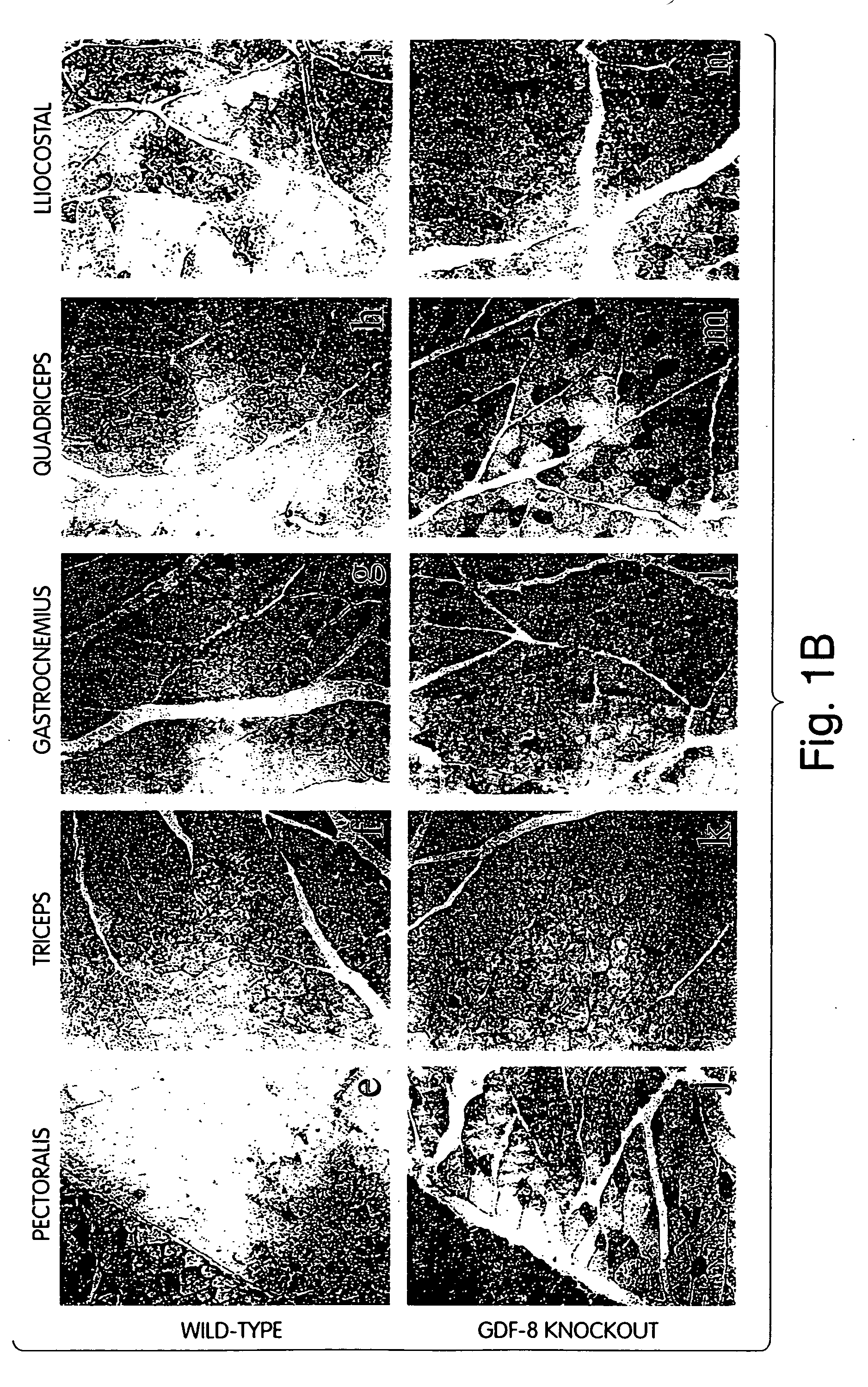 Methods for treating diabetes