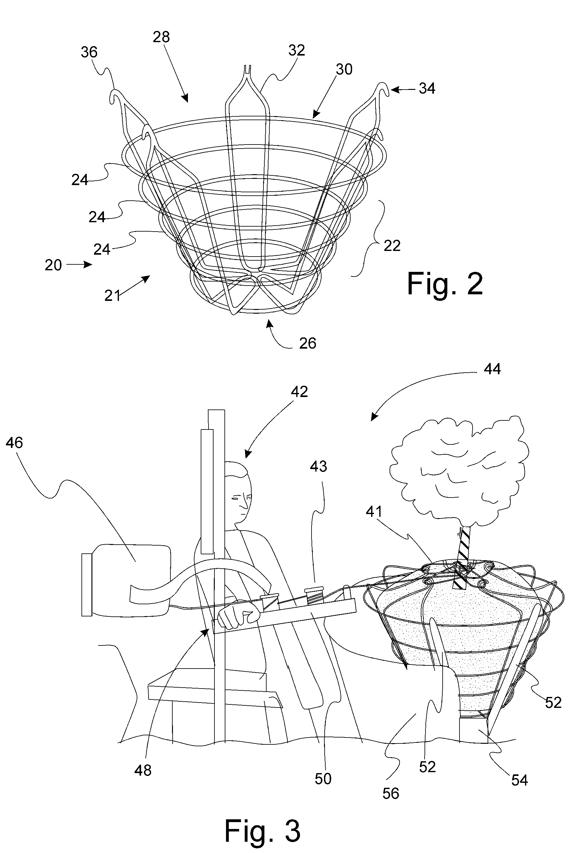 Tree Balling Method, System, and Wire Basket Used Therein