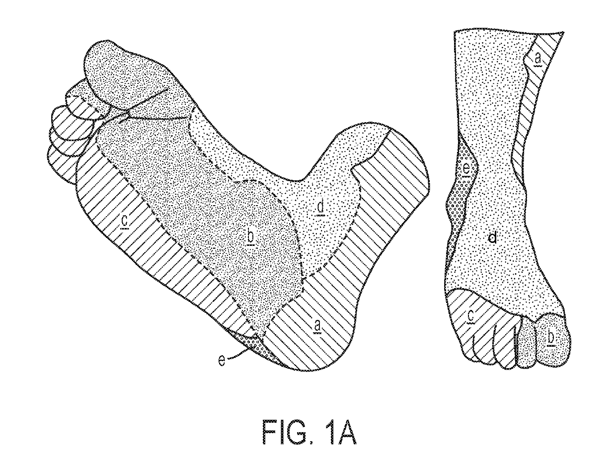 Monitoring Treatment of Peripheral Artery Disease (PAD) Using Diffuse Optical Imaging