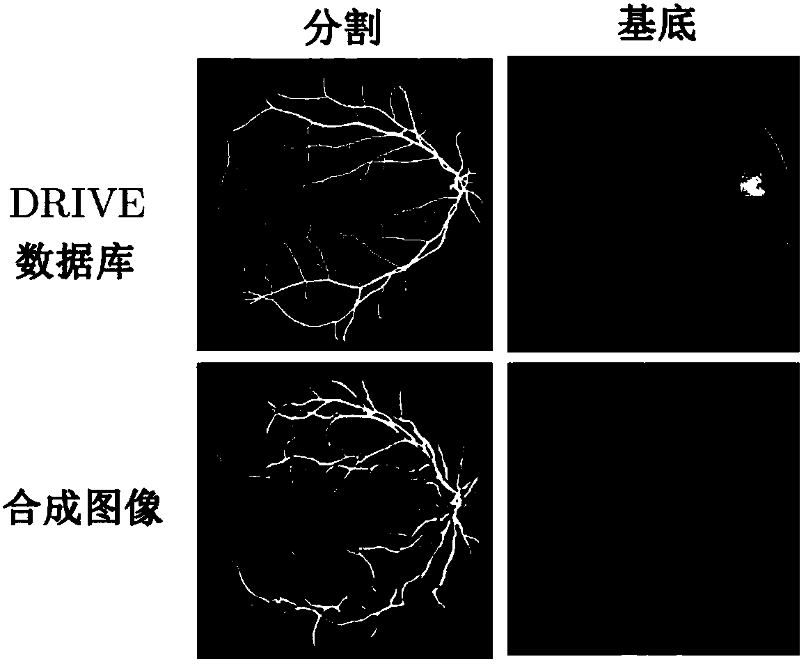 Medical image synthesis method based on double generative adversarial networks