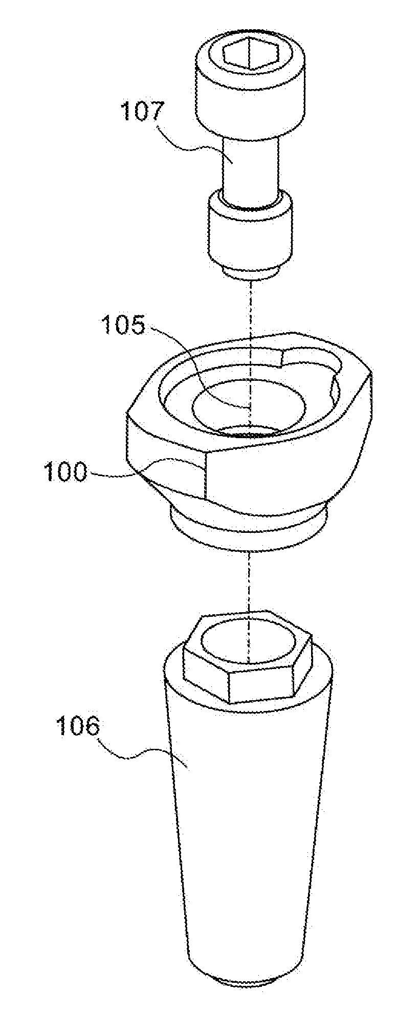 Dental implant procedure by scanning a closed tray impression