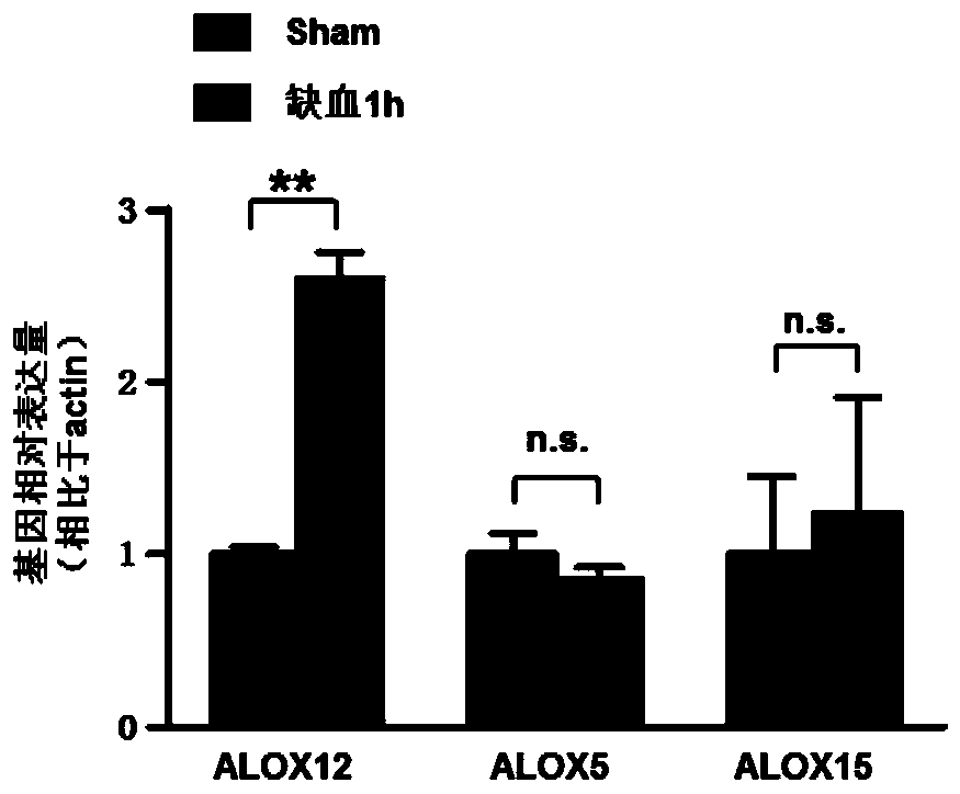 Application of arachidonate lipoxygenase (ALOX)12 inhibitor to preparation of heart ischemia reperfusion injury (IRI) therapeutic drug