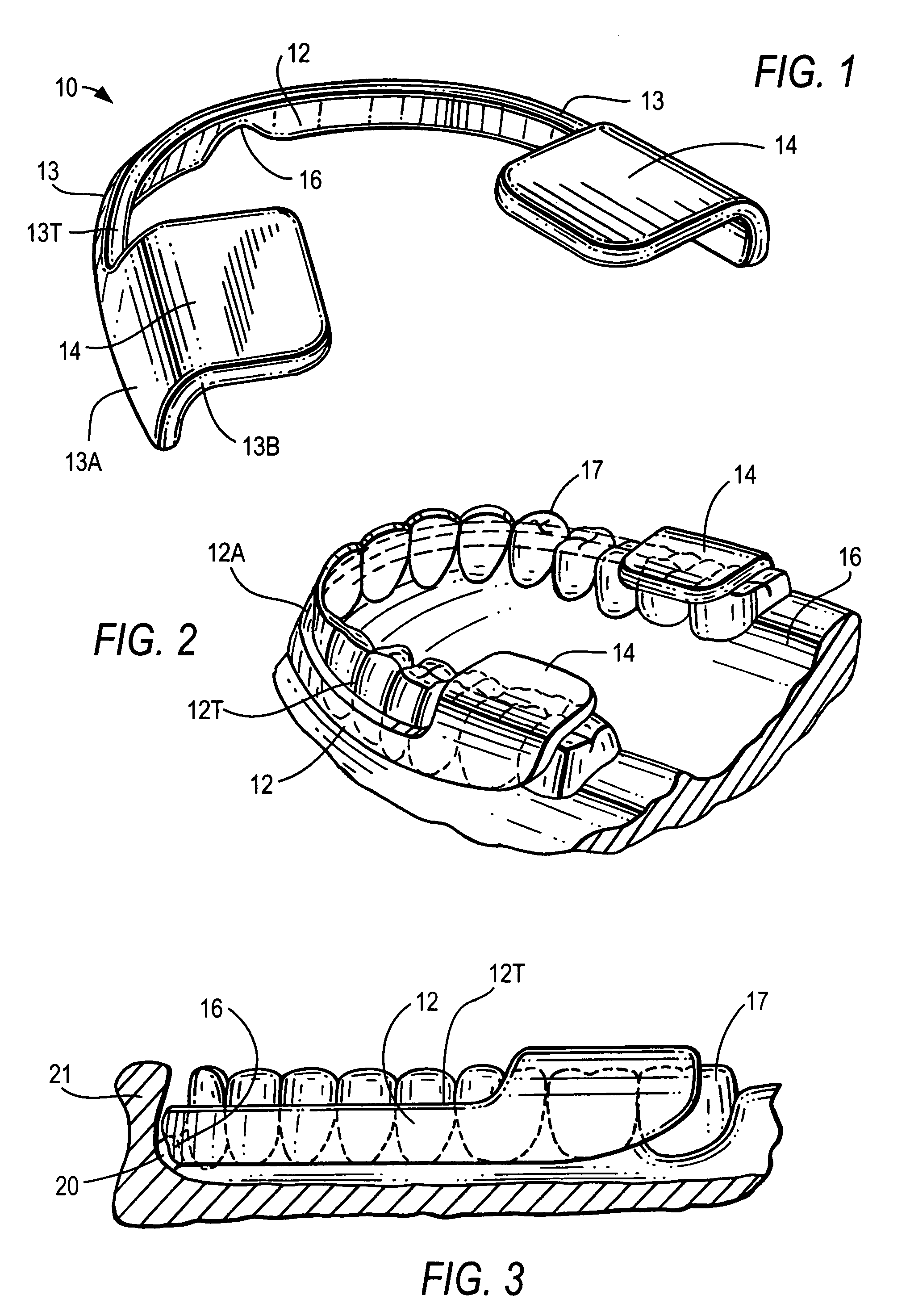 Bruxism protective device