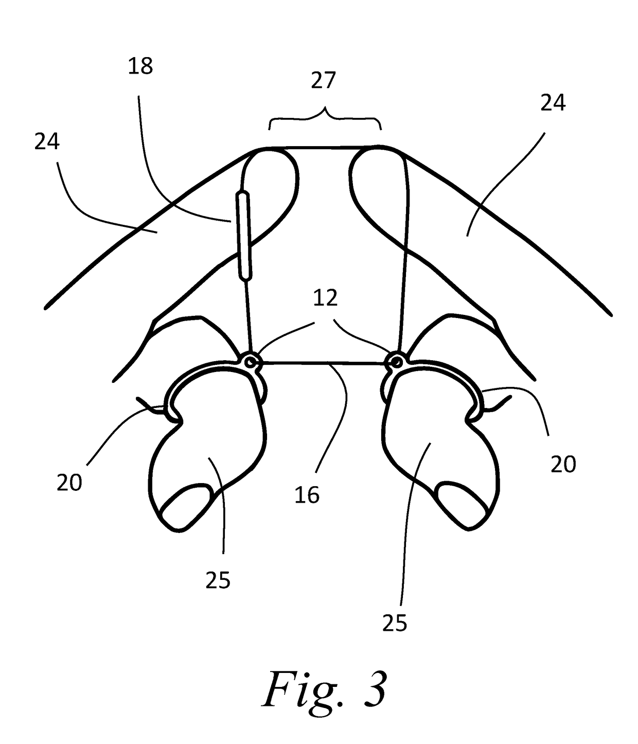 Oral hygiene device for the flossing of teeth