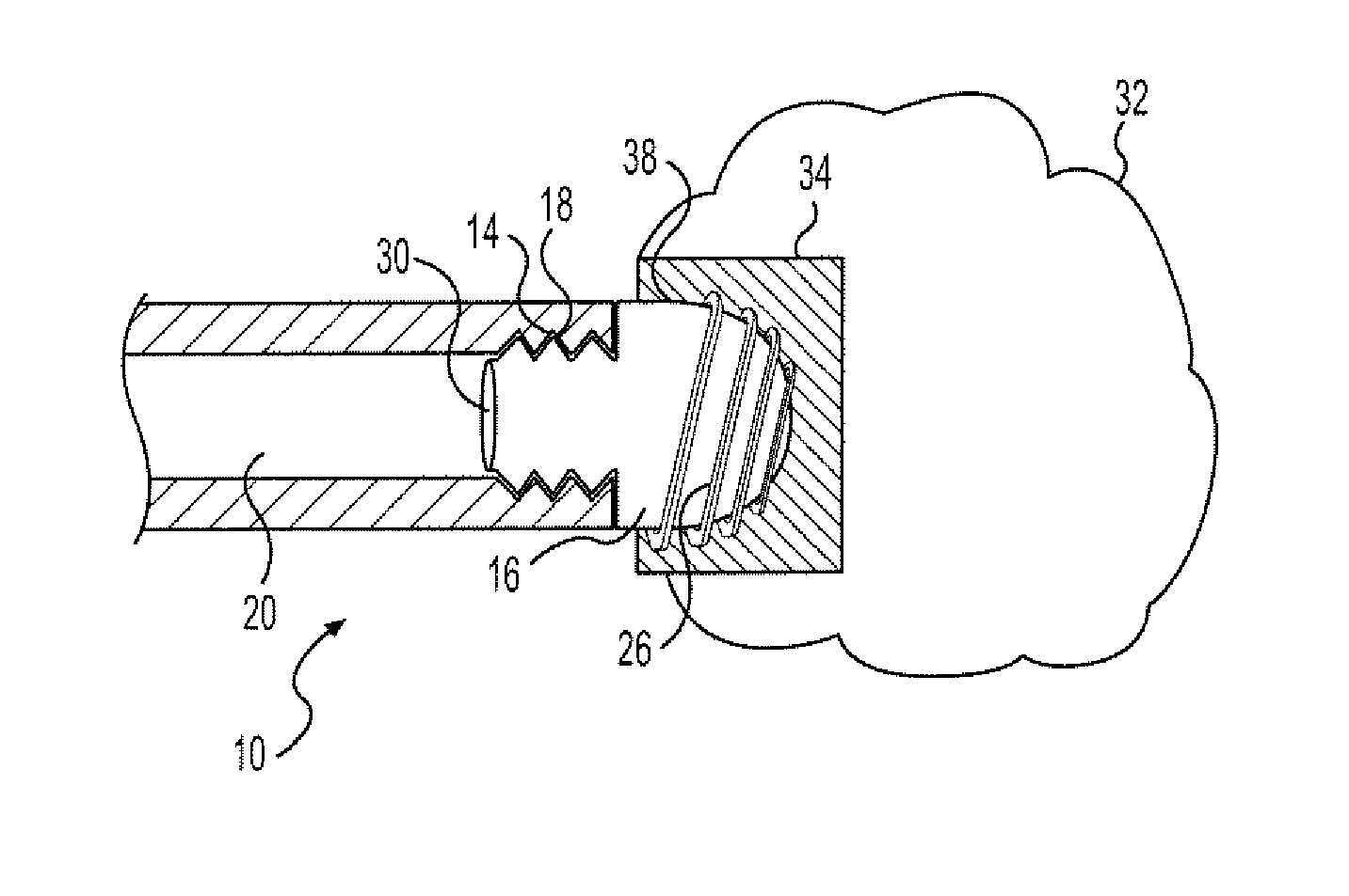 Medical devices for delivering  fluids during surgery and methods for their use