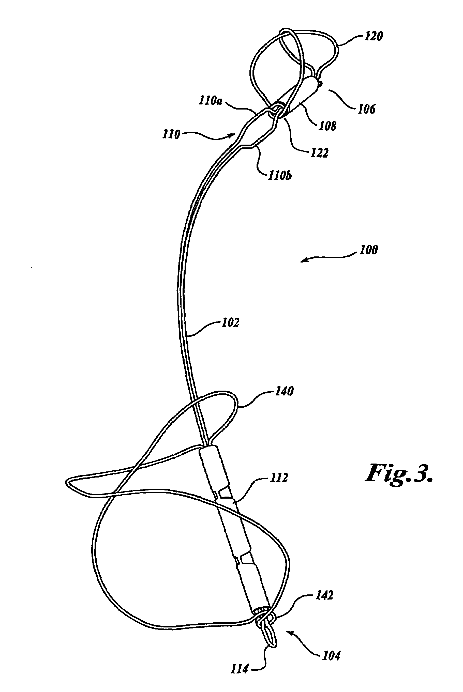 Device and method for modifying the shape of a body organ