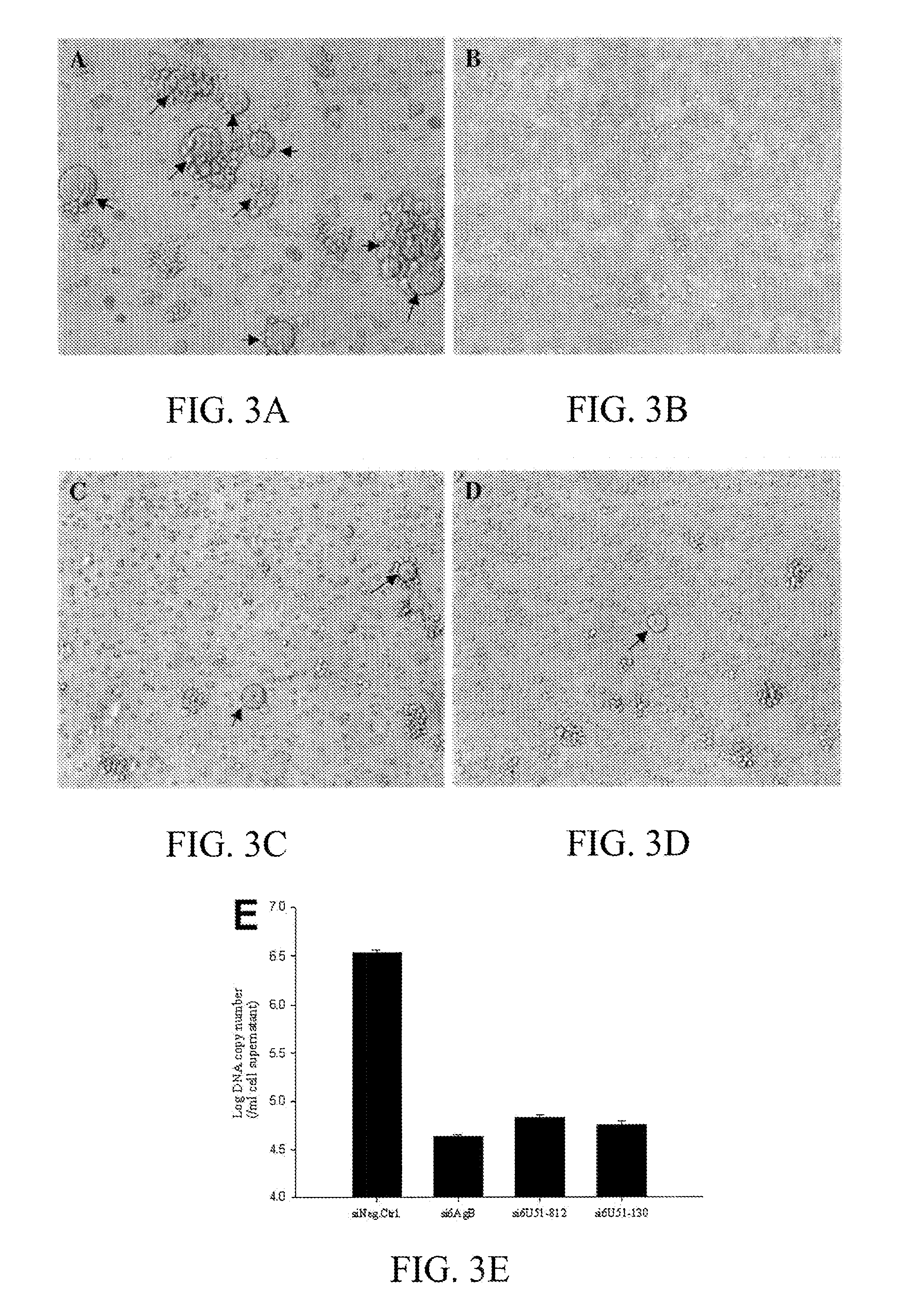 Compositions and methods for detection and treatment of human herpesvirus (HHV)-6