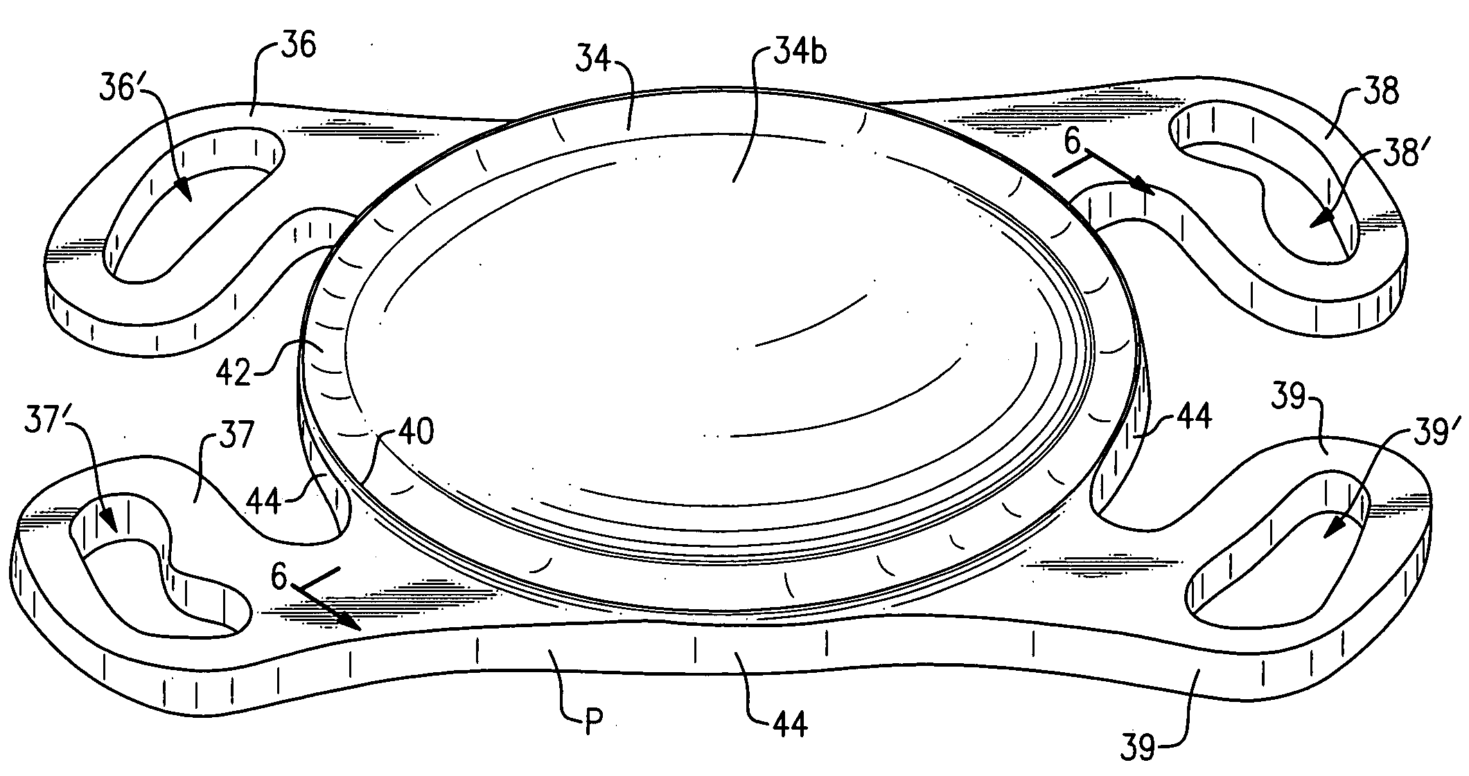 Small incision intraocular lens with anti-PCO feature