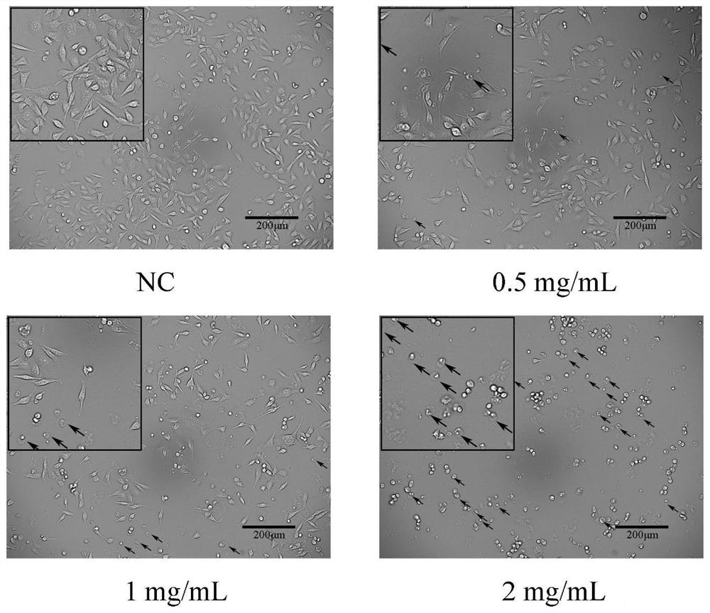 Application of lung cough in preparation of products for preventing and treating breast cancer