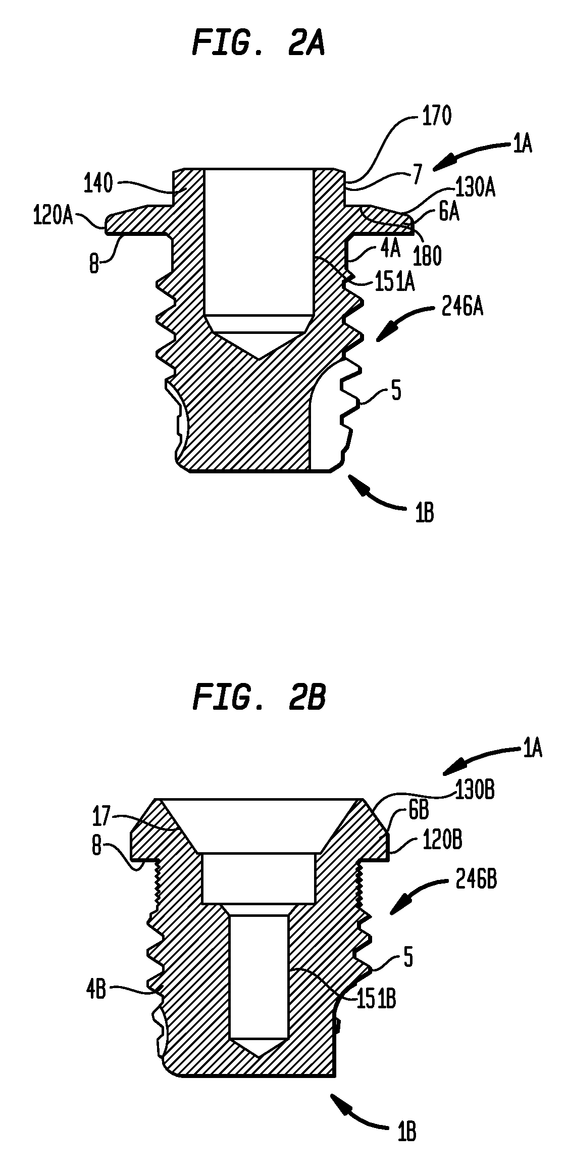 Implantable component of a hearing prosthesis