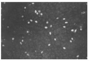 A kind of isolation method of porcine parvovirus