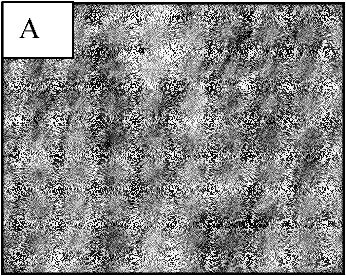 Human umbilical mesenchymal stem cell and preparation method thereof