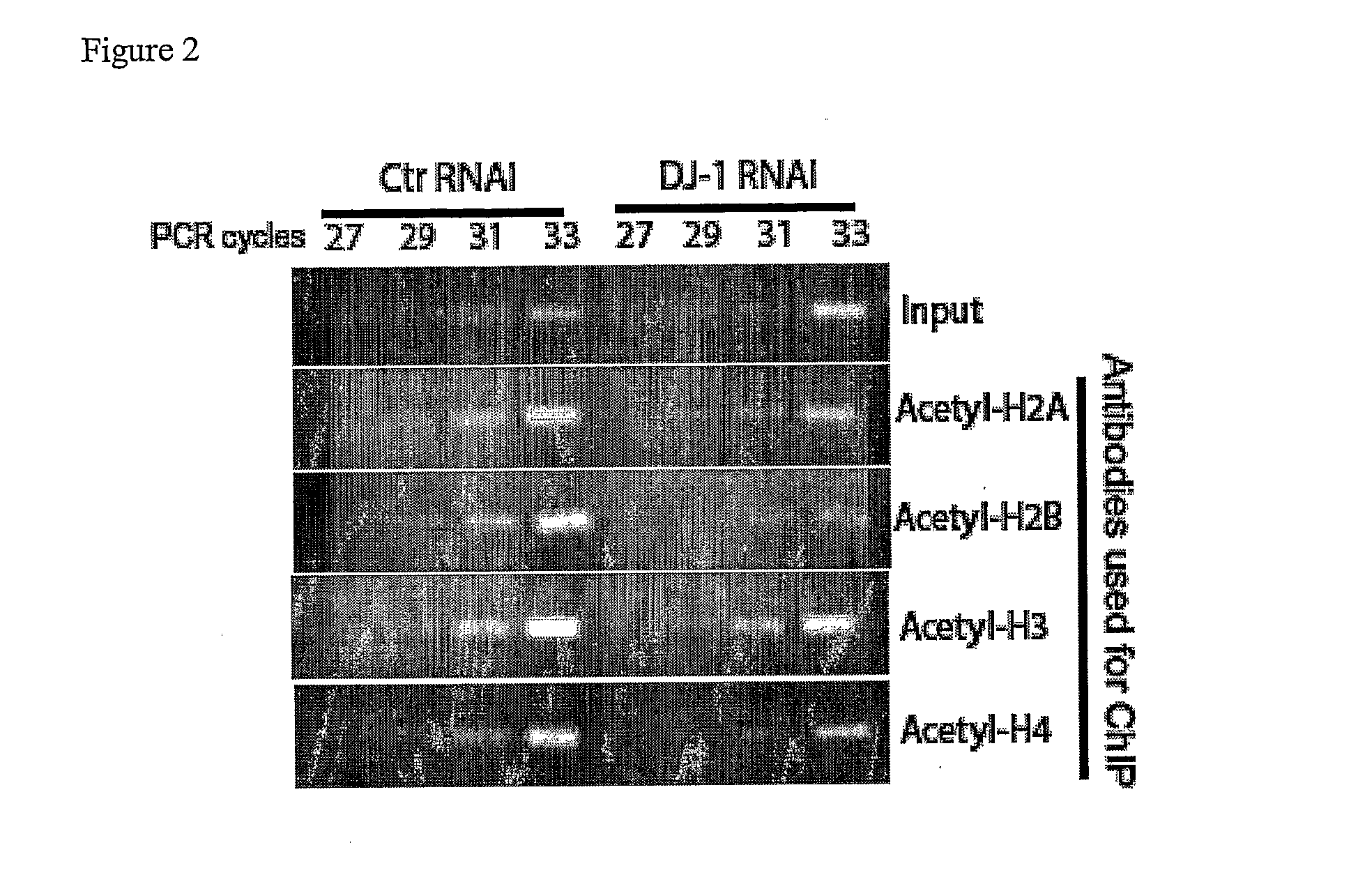 Use of Androgens for the Treatment of Parkinson's Disease