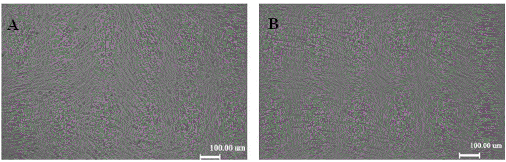 Cryopreservation liquid and cryopreservation method for adipose tissue-derived mesenchymal stem cells ( ADSC)