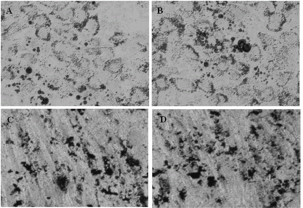 Cryopreservation liquid and cryopreservation method for adipose tissue-derived mesenchymal stem cells ( ADSC)