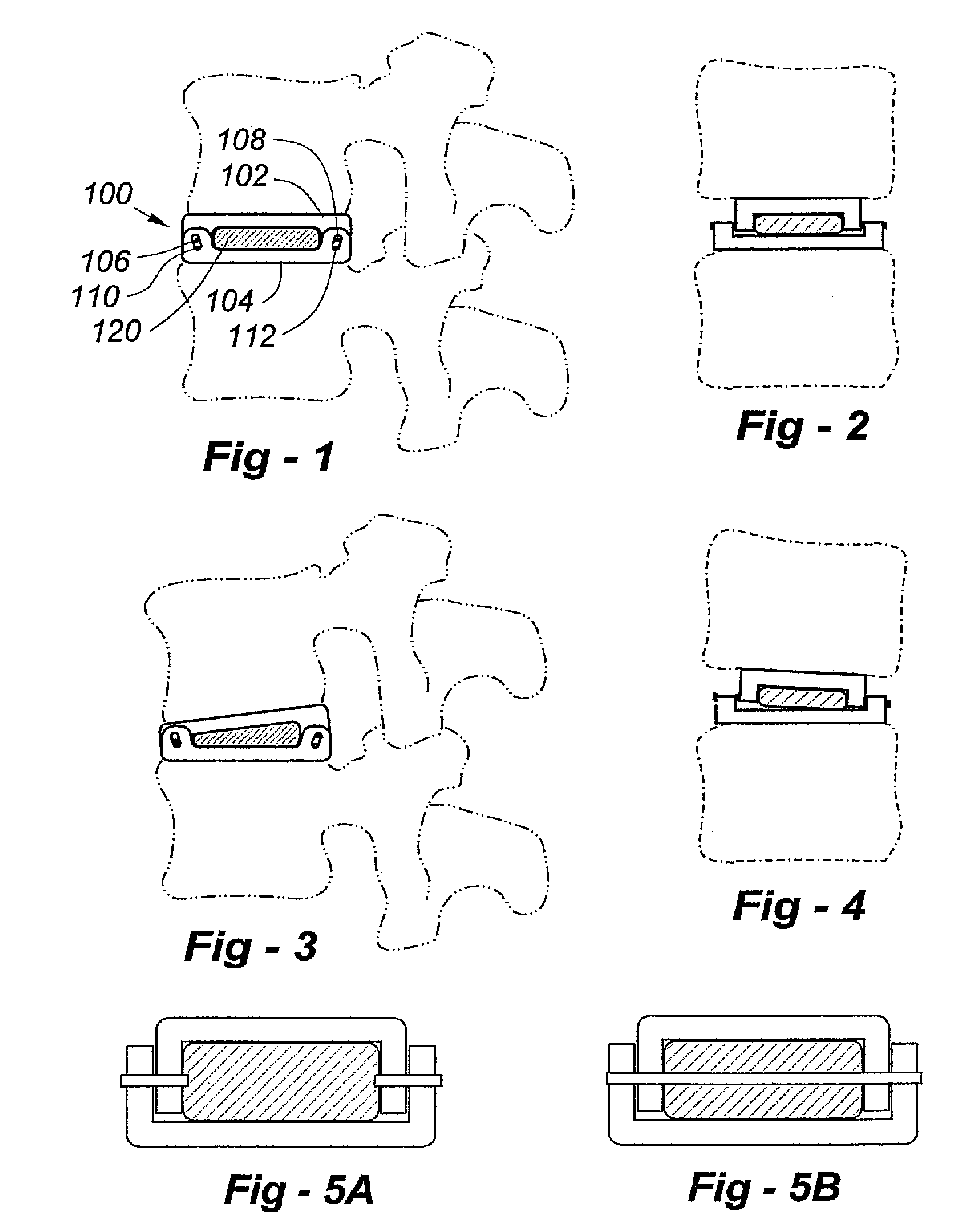 Biaxial artificial disc replacement