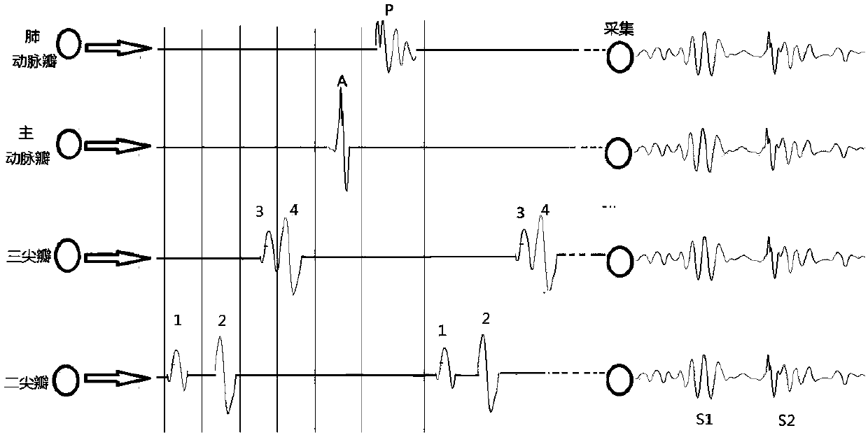 Method for acquiring heart sound signal source components