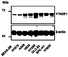 Application of human YTHDF1 (Youth-Tech-Health Domain Family Member 1) gene