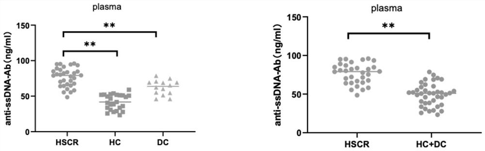 Application of anti-single-stranded DNA antibody as congenital megacolon diagnostic marker