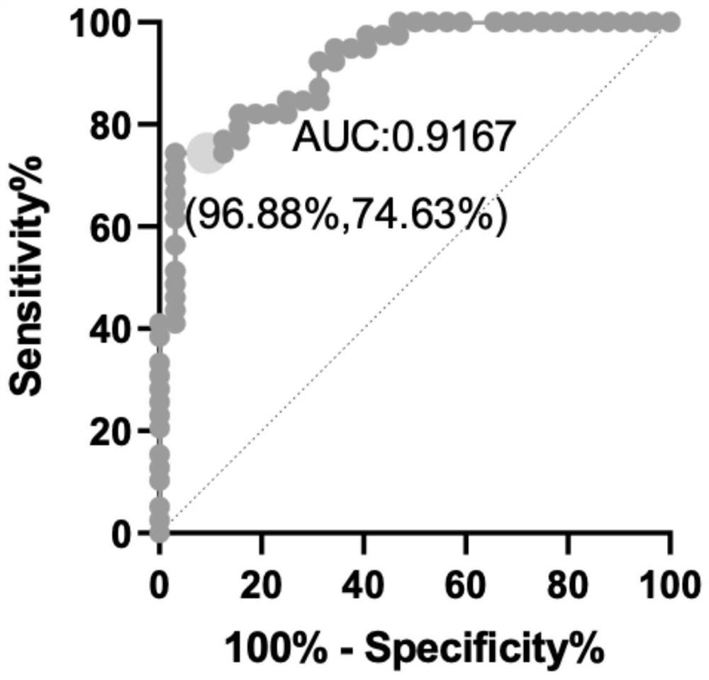 Application of anti-single-stranded DNA antibody as congenital megacolon diagnostic marker