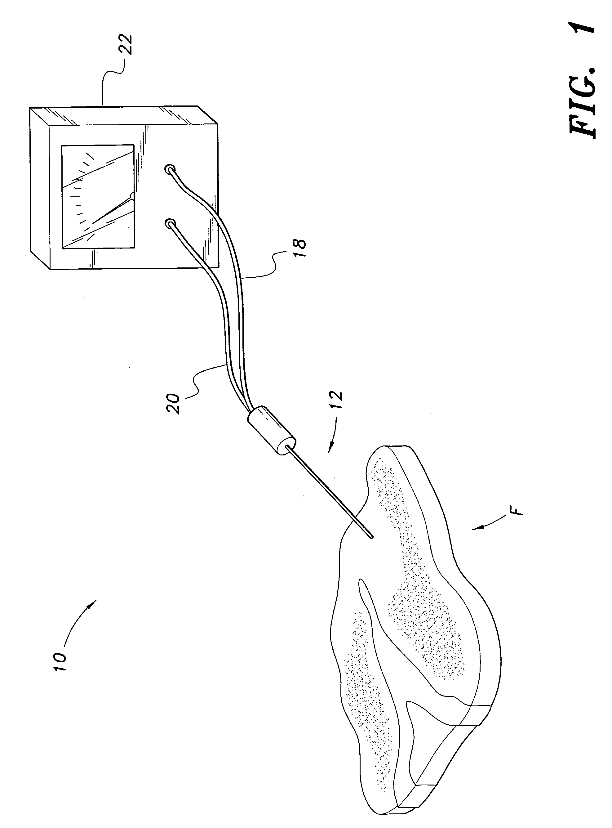 Device and method for testing food quality