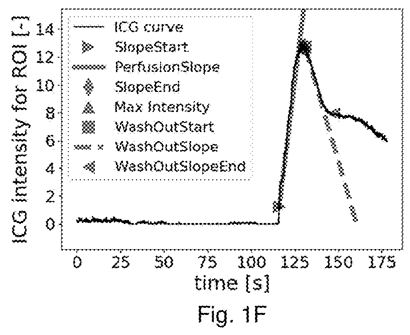 System and method for assessing perfusion in an anatomical structure