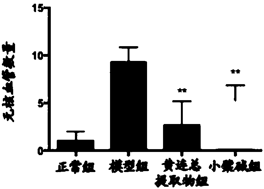 Compound composition for prevention or treatment of diabetic eye diseases, preparation method and use thereof