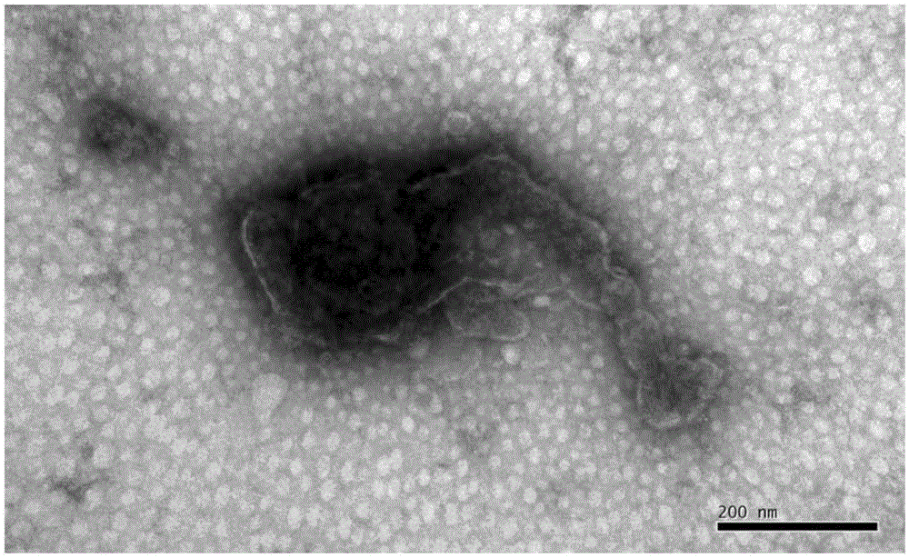 Chicken C-type acian metapneumovirus strain(aMPV-JCX) and application thereof