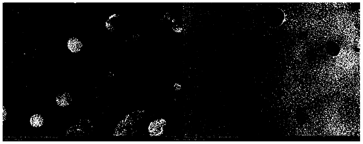 Nanometer cluster medicine carrying thermosensitive liposome preparation and making method and application thereof