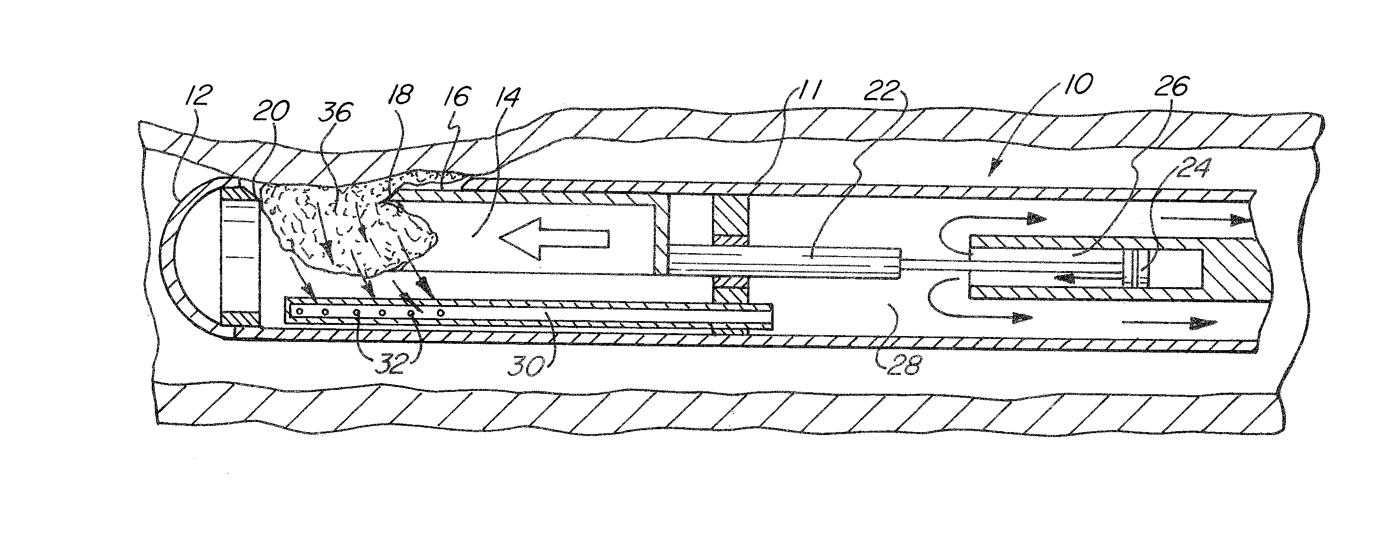 Pressure/Vacuum Actuated Catheter Forceps