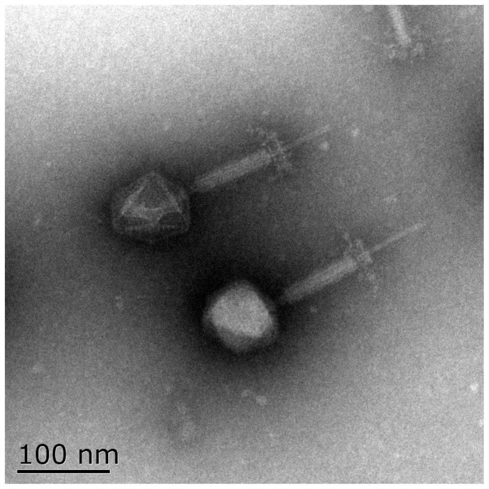 Staphylococcus aureus phage SapYZUalpha and application thereof