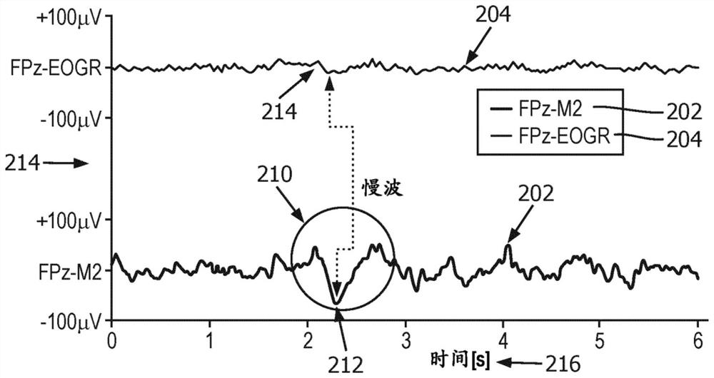 Enhancing deep sleep based on information from frontal brain activity monitoring sensors