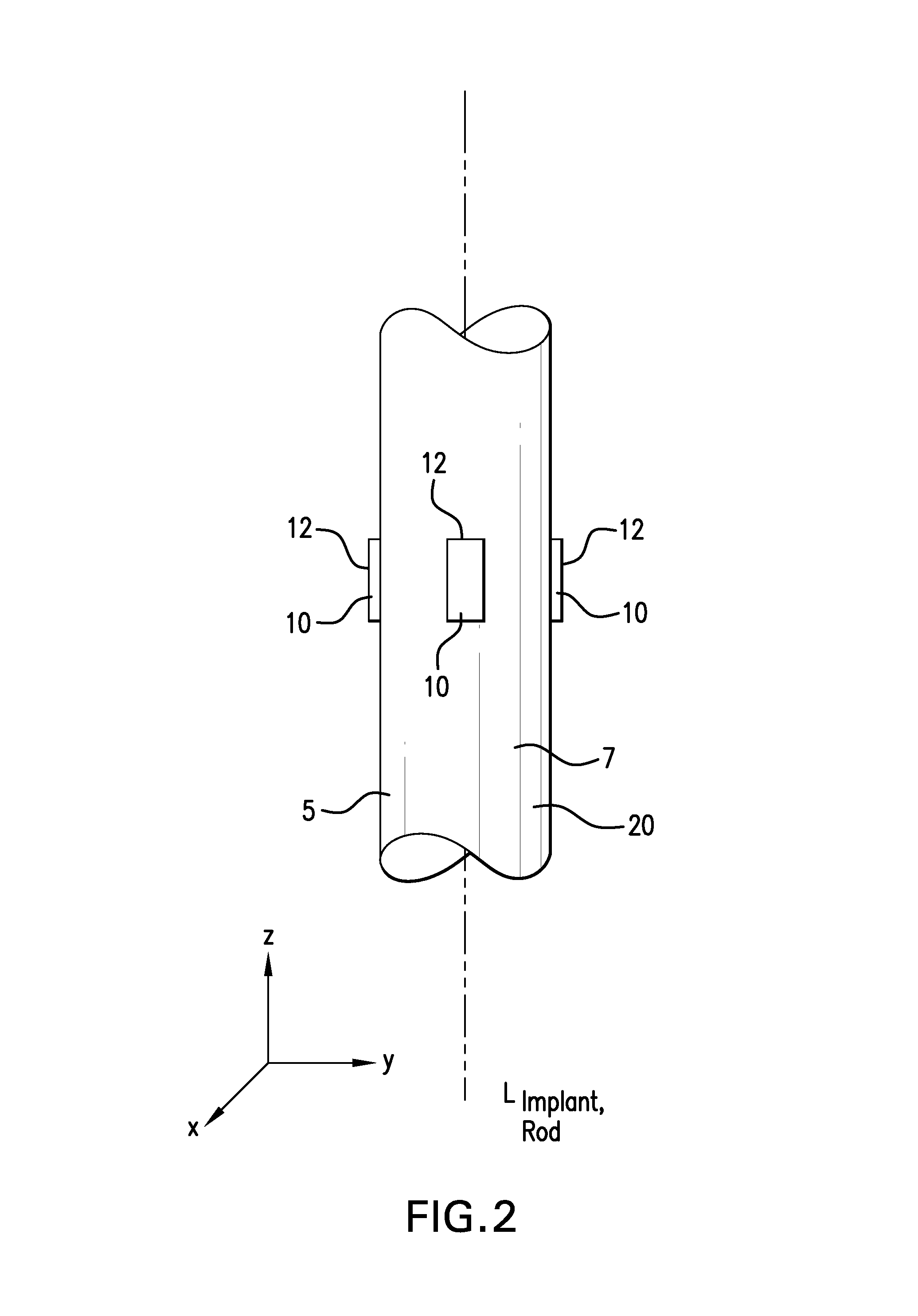 Strain monitoring system and apparatus