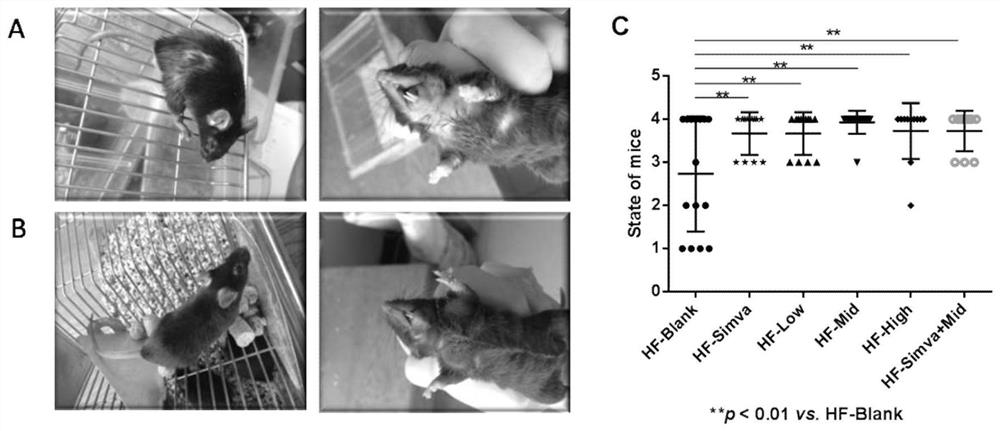 Application of 2, 3-indolequinone in preparation of medicine for treating or preventing atherosclerotic cardiovascular and cerebrovascular diseases