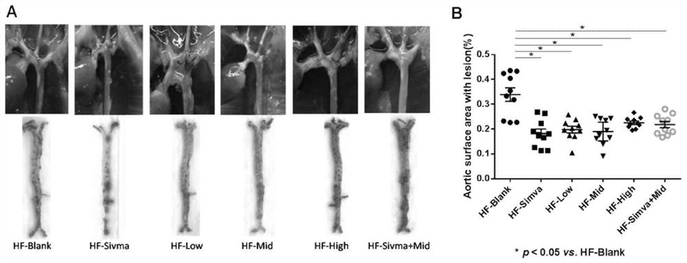 Application of 2, 3-indolequinone in preparation of medicine for treating or preventing atherosclerotic cardiovascular and cerebrovascular diseases