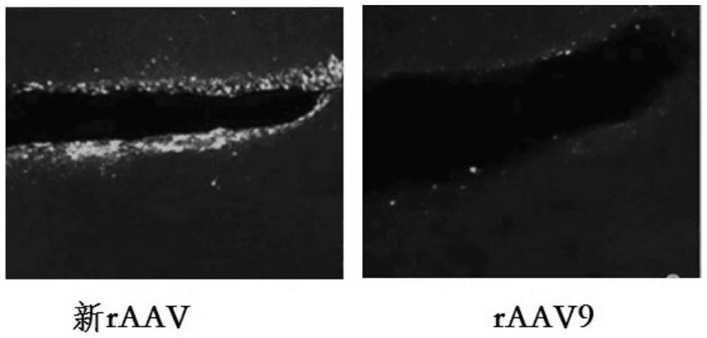 Delivery vector for specific gene of neural stem cell and application of delivery vector