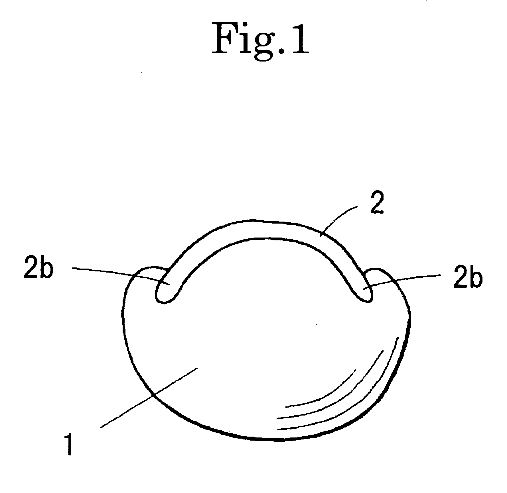 Apparatus for Correcting an Ingrown Nail