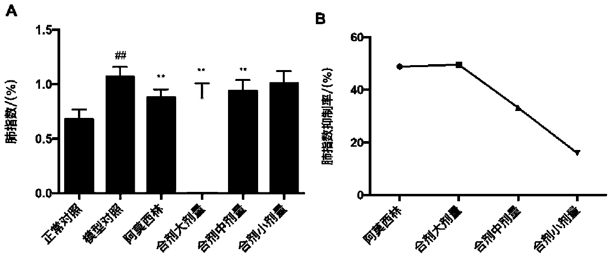 Antiviral traditional Chinese medicine composition for respiratory system