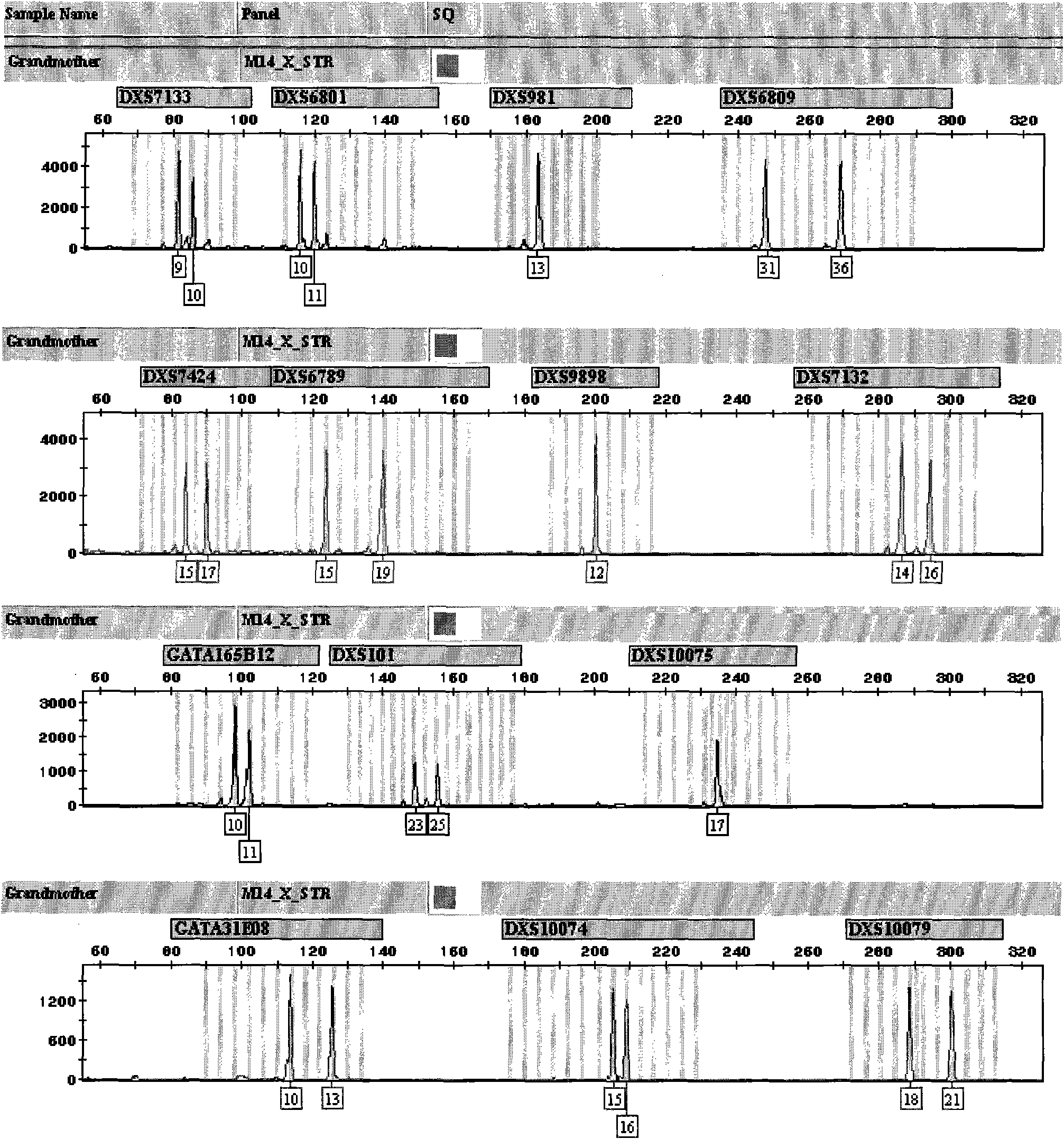 X-STR locus fluorescence labeling composite amplification system and application thereof