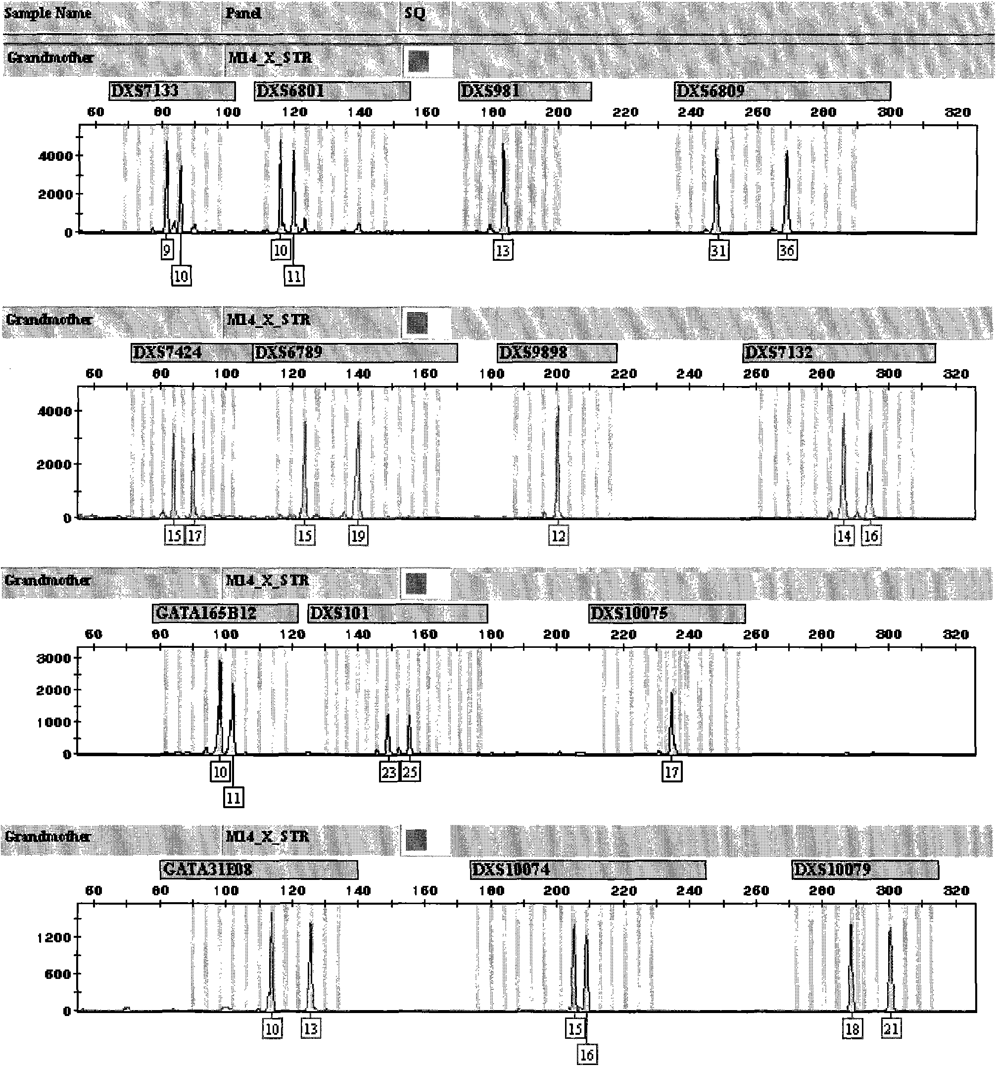 X-STR locus fluorescence labeling composite amplification system and application thereof