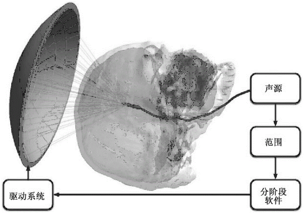 Ultrasonic transcranial focusing method