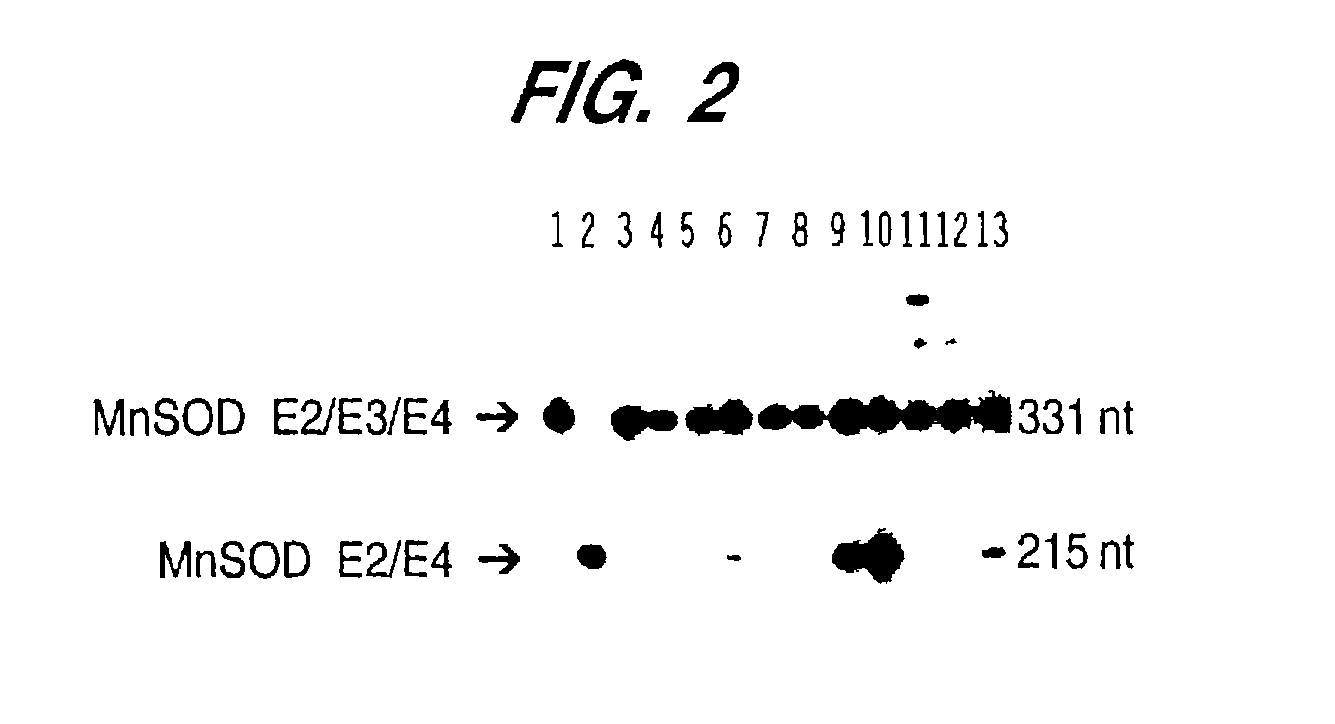 Manganese superoxide dismutase exon 3-deleted isoforms and nucleic acid molecules encoding the isoforms