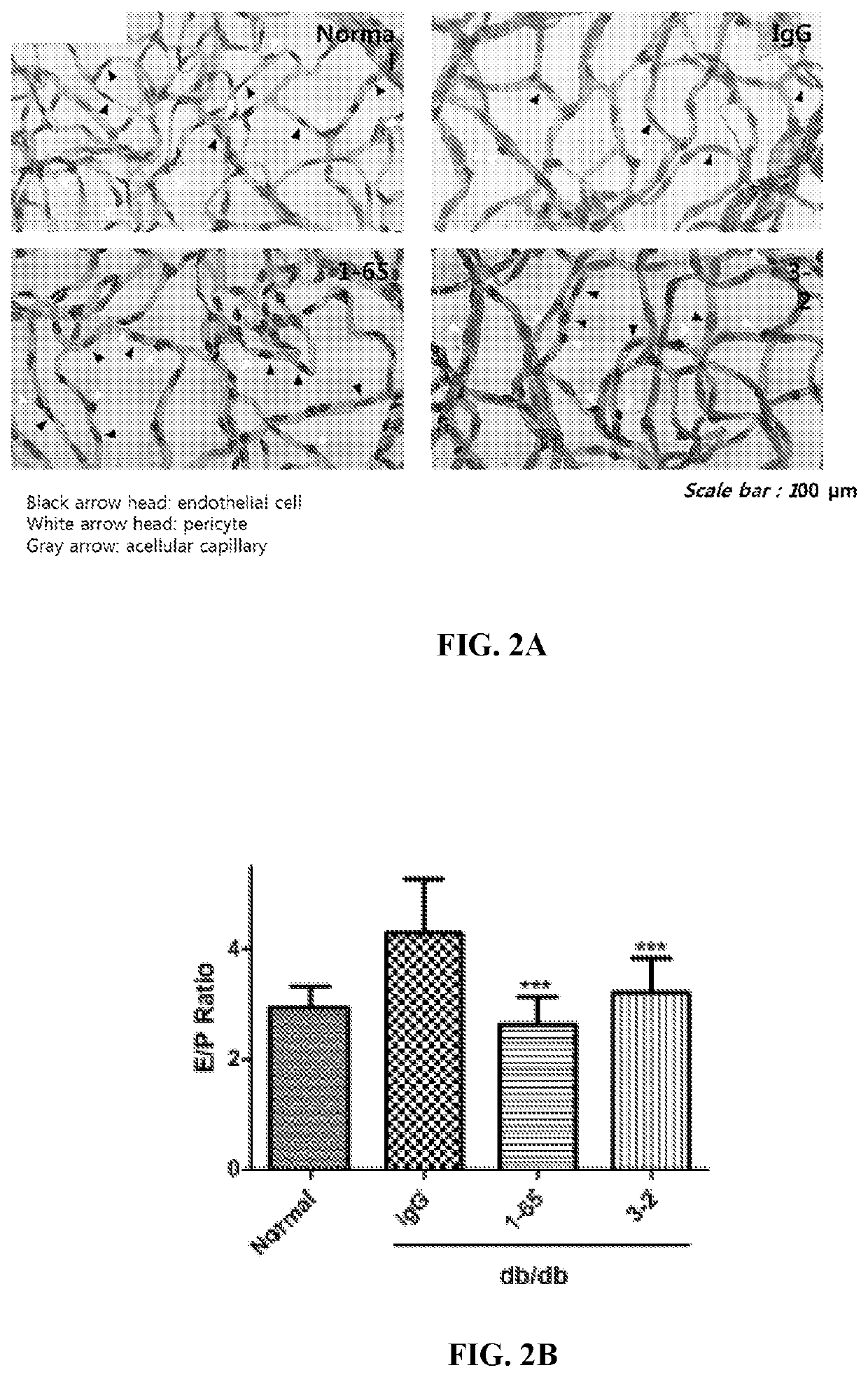 Use of Anti-fam19a5 antibodies