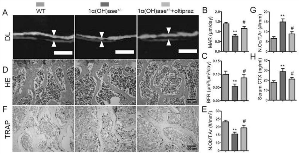 Application of oltipraz in preparation of product for preventing and treating osteoporosis