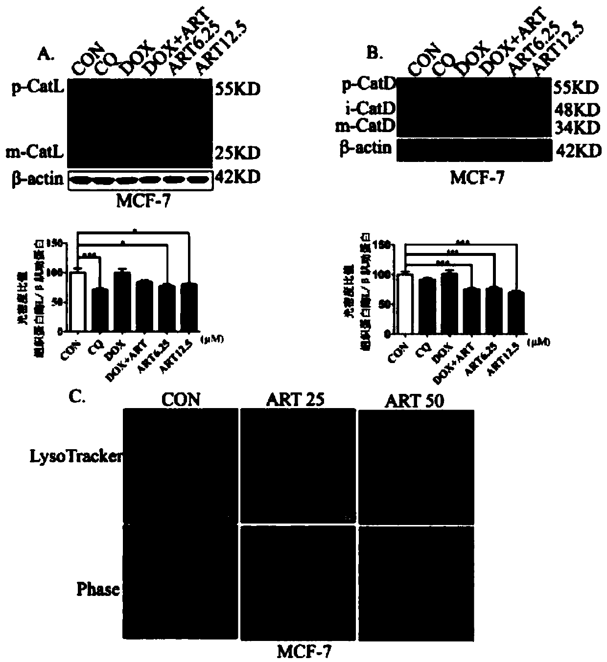 Application of artesunate in preparation of drug for inhibiting tumor cell drug resistance