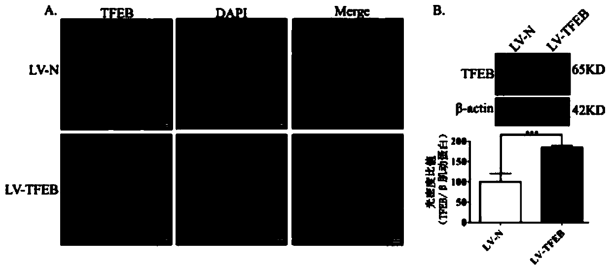 Application of artesunate in preparation of drug for inhibiting tumor cell drug resistance