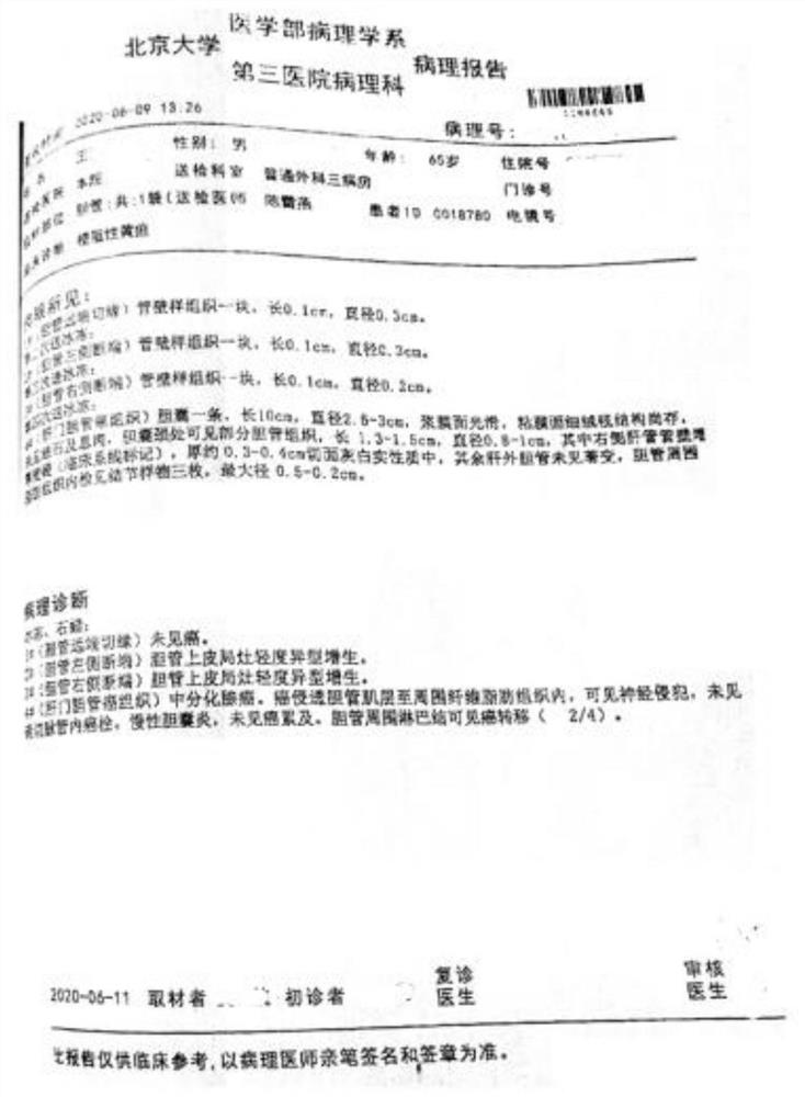 Traditional Chinese medicine composition for treating postoperative hepatic cholangiocarcinoma and cancerometastasis