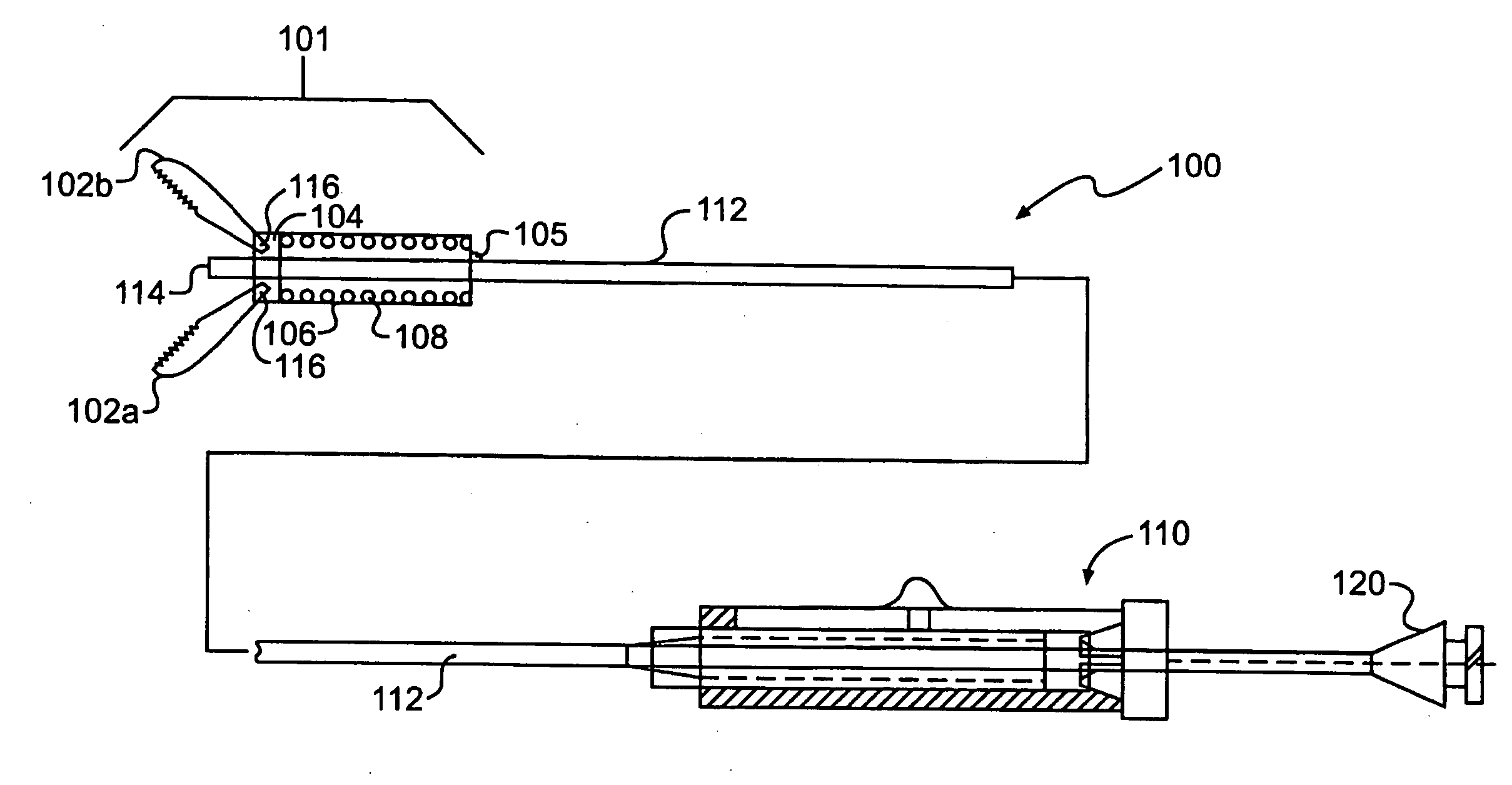 Endoscopic apparatus and method